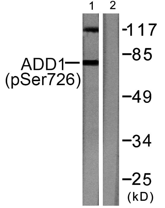 ADD1 / Adducin Alpha Antibody (phospho-Ser726)