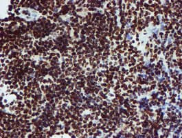 Monoclonal Mouse anti-Human PADI4 / PAD4 Antibody (clone OTI4H5, IHC, IF, WB)