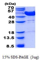 Human MVK Protein (Recombinant His)