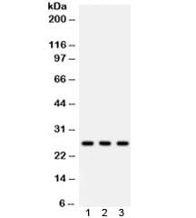 Polyclonal Rabbit anti-Human SFTPA1 + SFTPA2 Antibody (IHC, WB)
