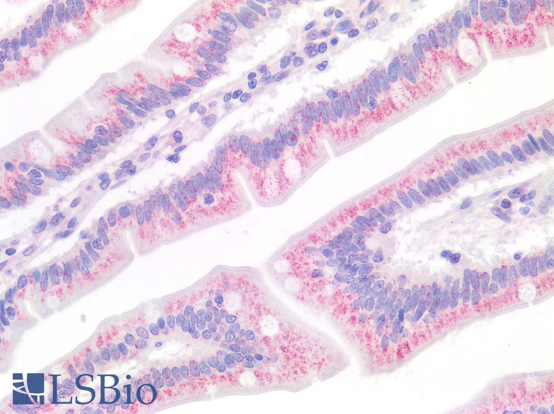 IHC-plus™ Polyclonal Rabbit anti-Human ACOX1 / ACOX Antibody (IHC, WB)