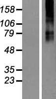 GABRB3 Protein (Over-Expression Lysate Myc-DDK (Flag))