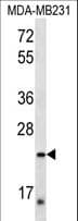 PEX11A Antibody (aa137-165)