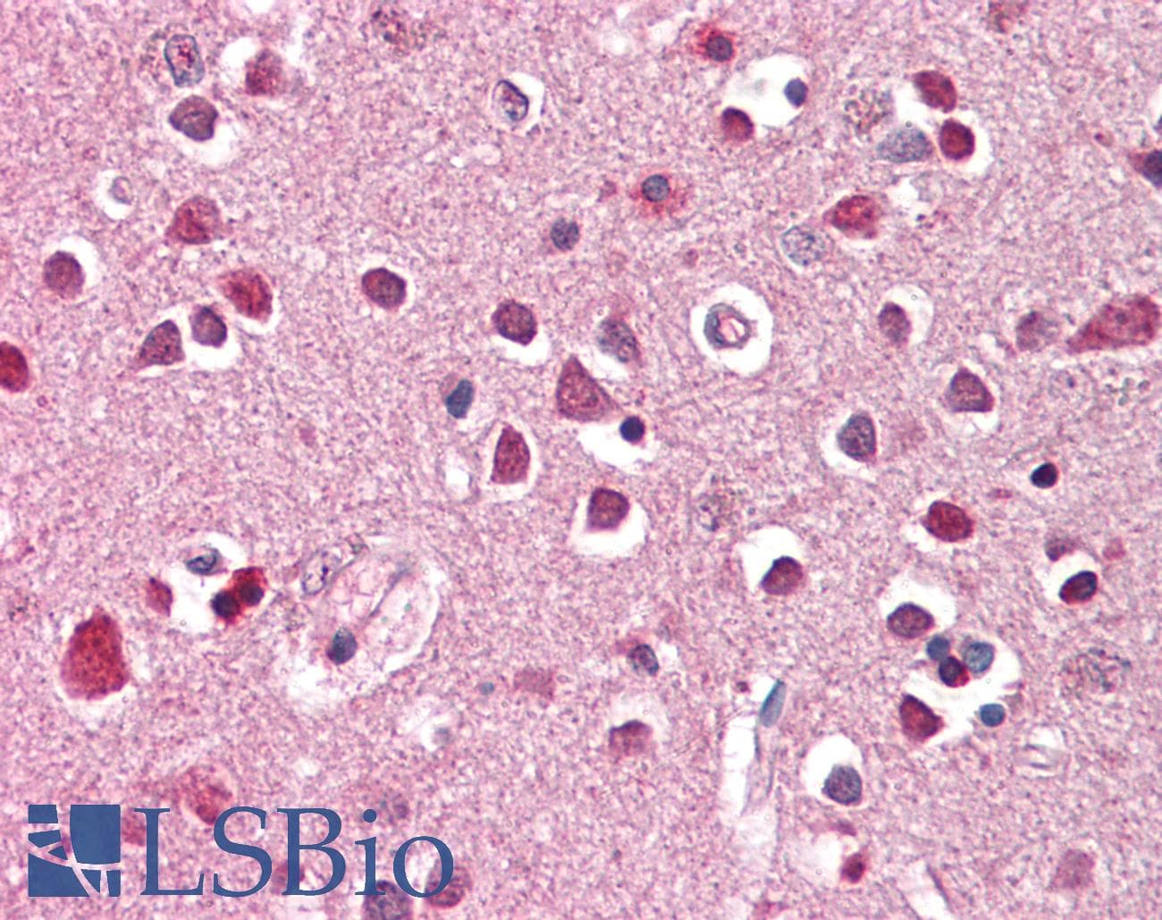 IHC-plus™ Polyclonal Goat anti-Human XAB2 Antibody (aa843-855, IHC, WB)