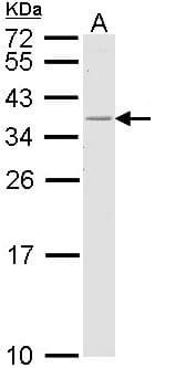 IHC-plus™ HLA-DR Antibody