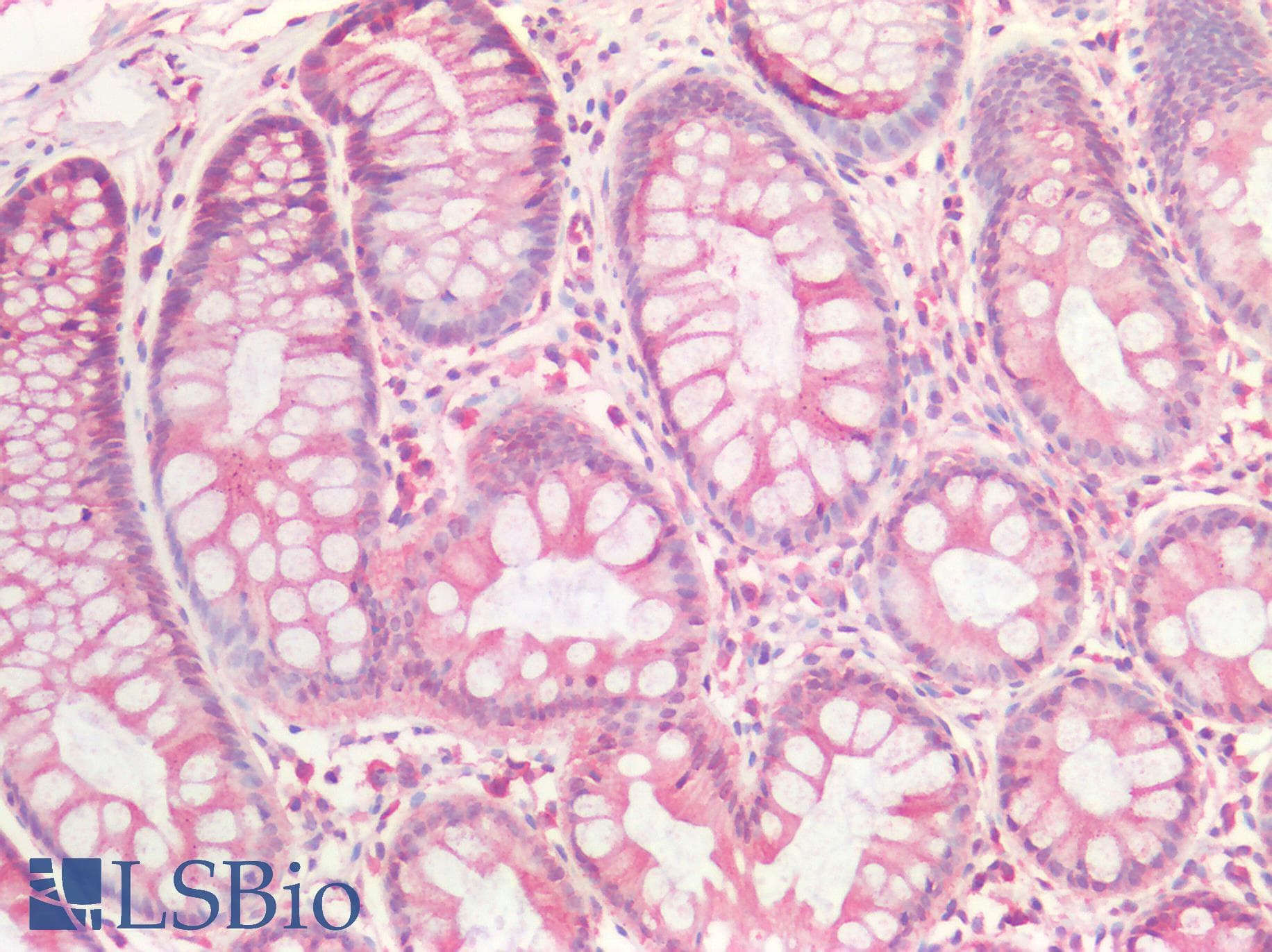 IHC-plus™ EPHB2 / EPH Receptor B2 Antibody (C-Terminus)