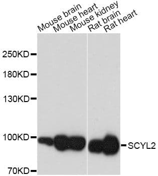 SCYL2 Antibody