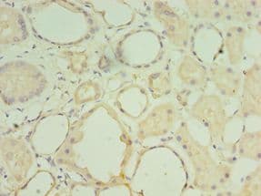 MATN3 / Matrilin 3 Antibody (aa277-486)