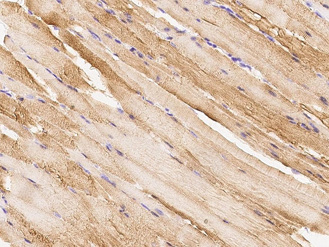 CKM / Creatine Kinase MM Antibody (Preservative Free)