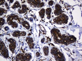 HSPD1 / HSP60 Antibody (clone OTI3G1)