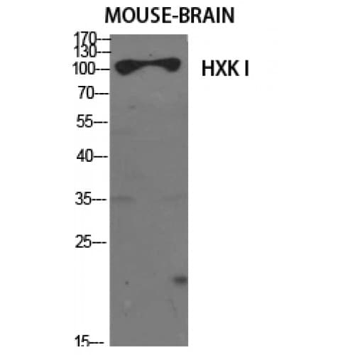 HK1 / Hexokinase 1 Antibody (1-80 aa, N-terminal)
