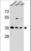 Polyclonal Rabbit anti-Human FBXO2 Antibody (aa244-271, WB)