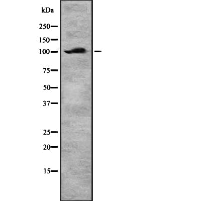 DAB2 Antibody