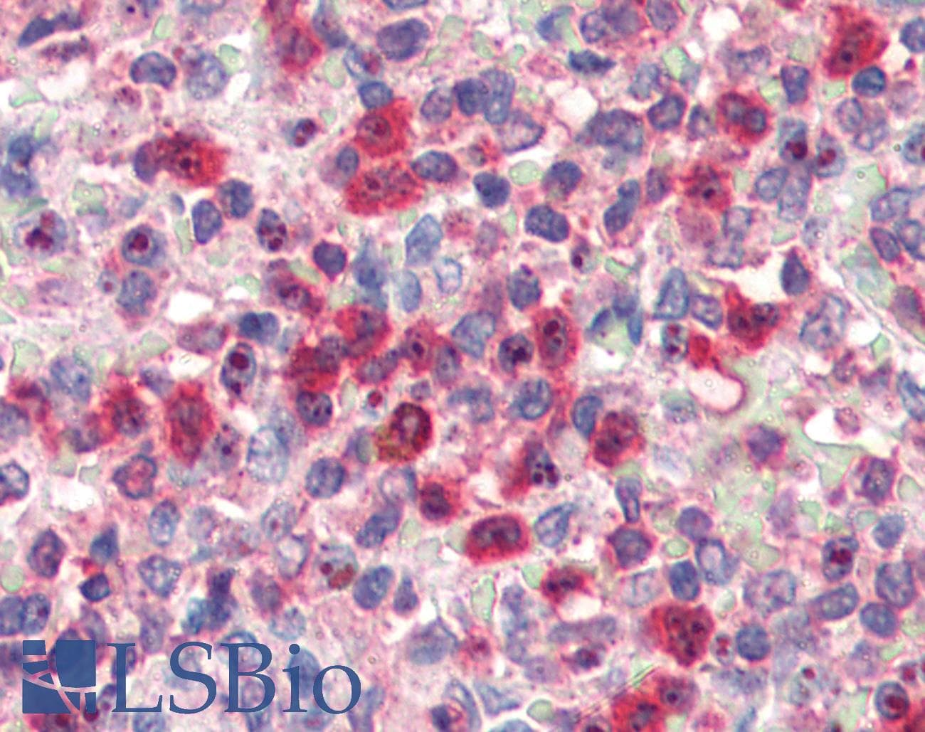 IHC-plus™ Polyclonal Goat anti-Human G6PD Antibody (aa305-318, IHC, WB)
