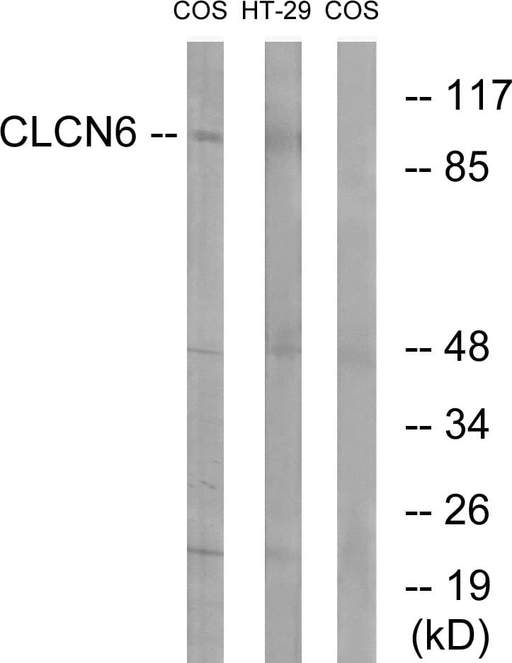 CLCN6 Antibody (aa611-660)