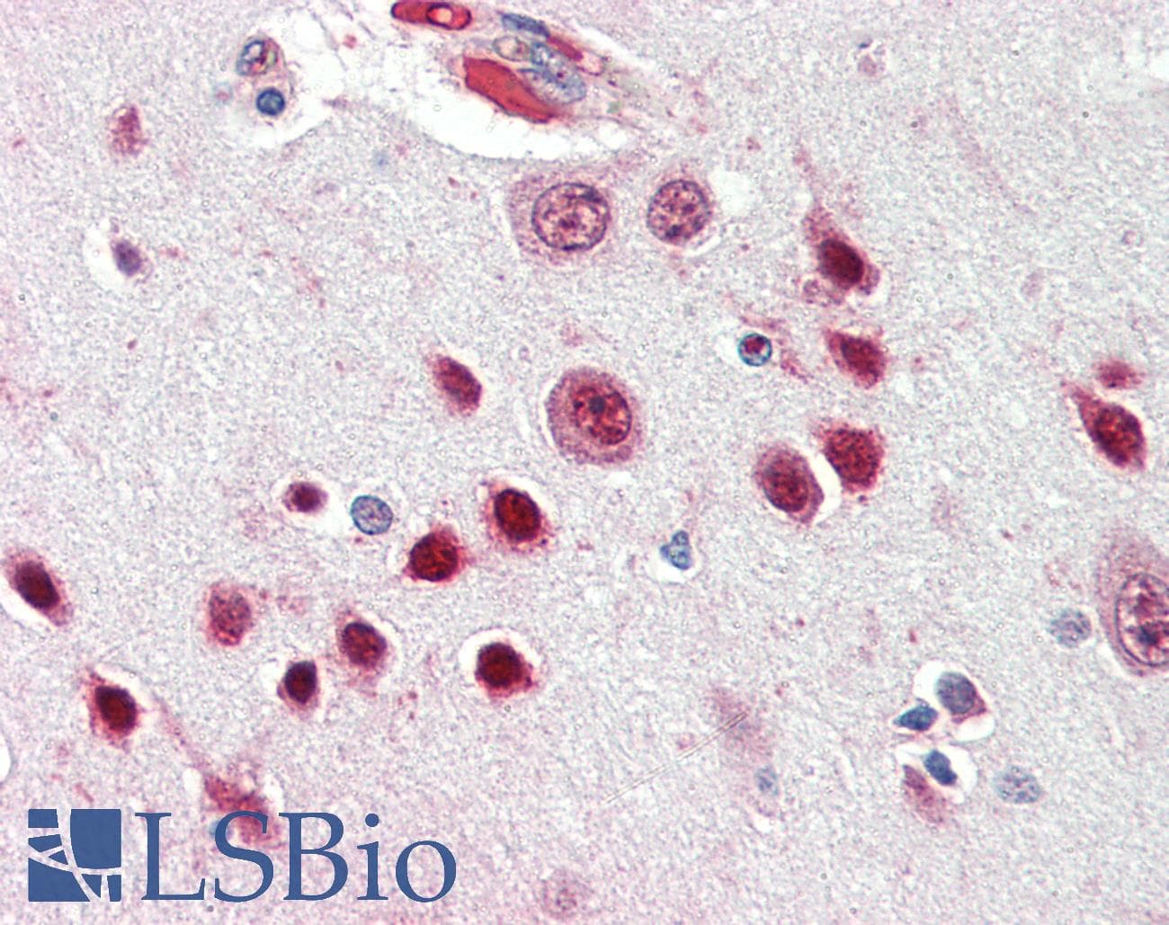 IHC-plus™ NOVA1 Antibody (aa121-134)
