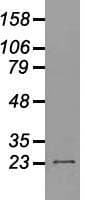 Monoclonal Mouse anti-Human NEUROG1 / NGN1 / Neurogenin 1 Antibody (clone OTI8G8, IF, WB)