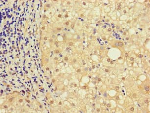 NRIP3 Antibody