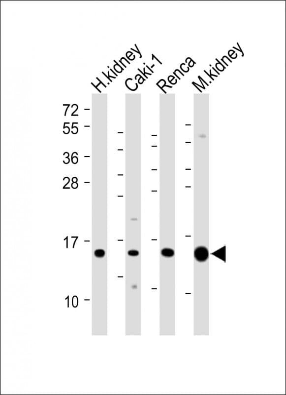 ATP6V1G3 Antibody (N-Terminus)