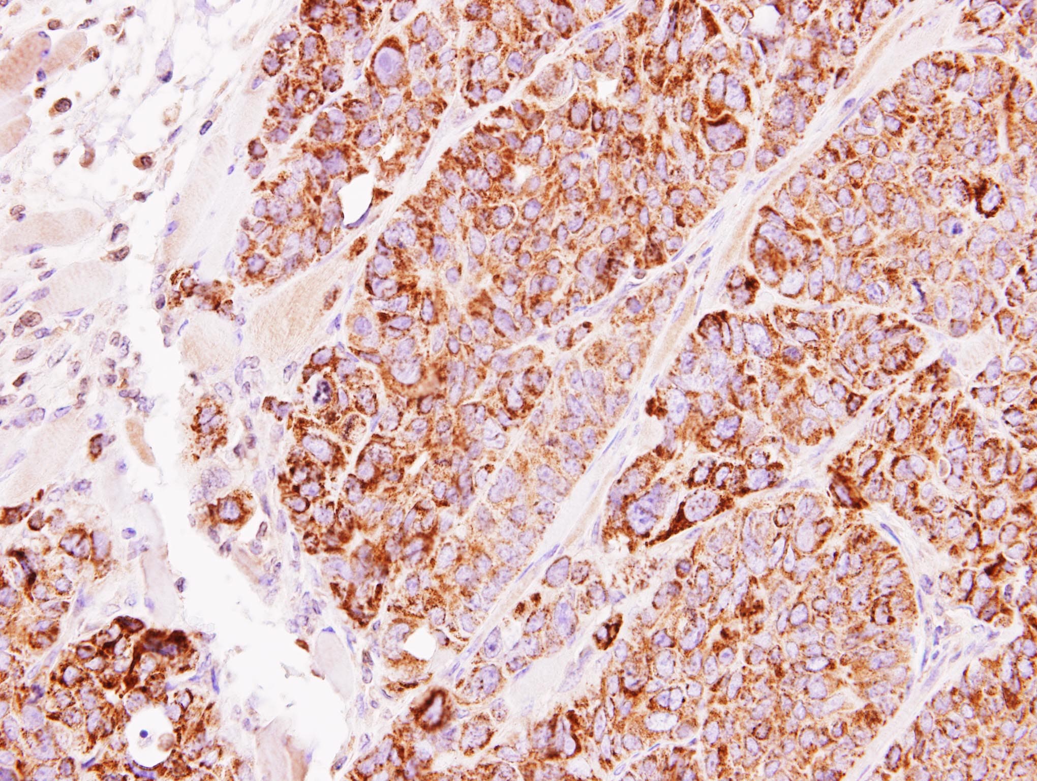 TBRG4 Antibody (aa1-270)