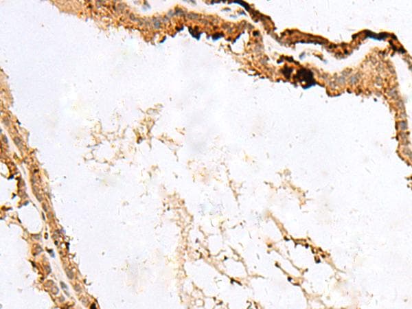 Polyclonal Rabbit anti-Human RABGGTA Antibody (IHC)