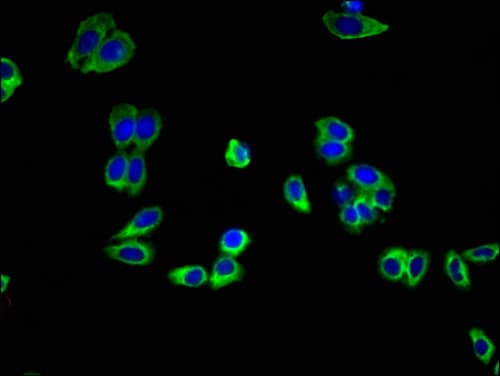Polyclonal Rabbit anti-Human ADIPOR1/Adiponectin Receptor 1 Antibody (IHC, IF, WB)
