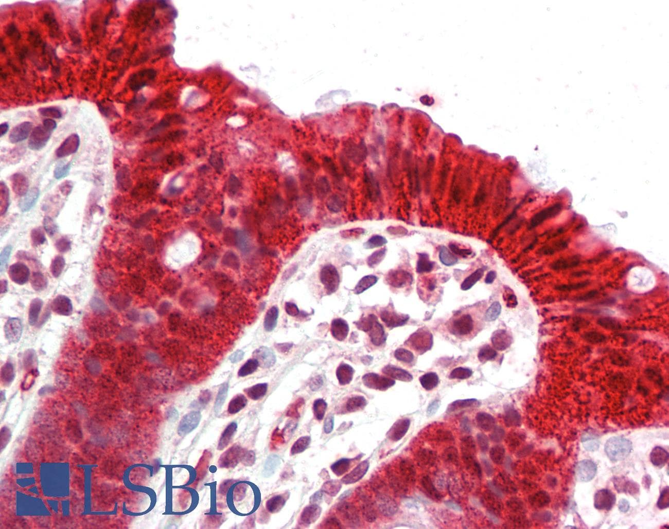 IHC-plus™ CLDN4 / Claudin 4 Antibody