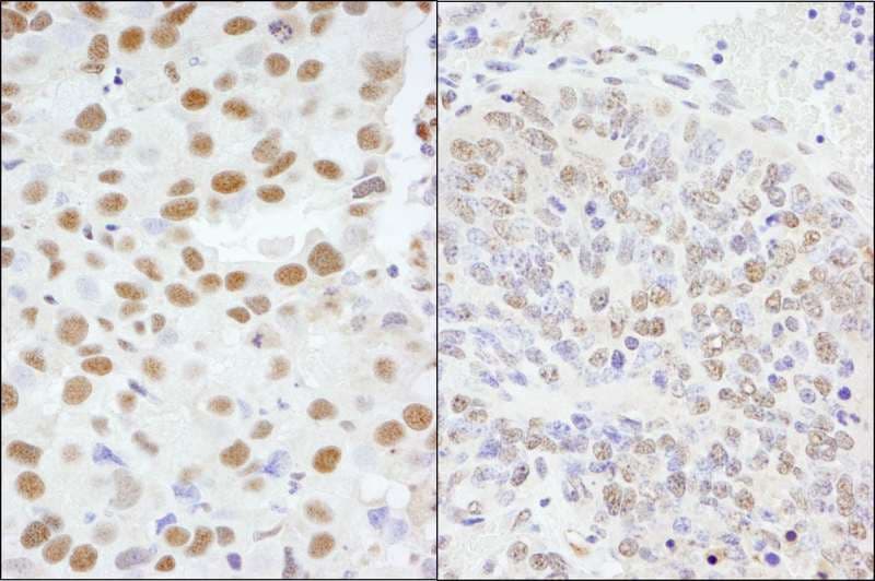AKAP8 / AKAP95 Antibody (aa642-C-term)