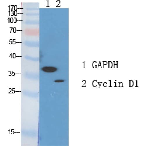 CCND1 / Cyclin D1 Antibody (220-300 aa)