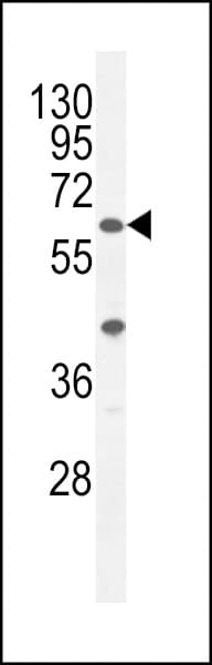 A1CF / ACF Antibody (aa394-423)