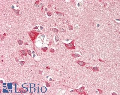 Polyclonal Rabbit anti-Human GFRA1 / GFR Alpha Antibody (aa239-350, IHC, WB)