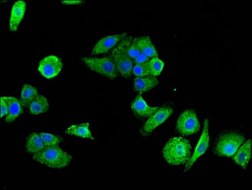 P2RX1 / P2X1 Antibody