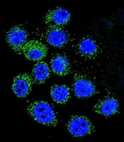 Polyclonal Rabbit anti-Human IGF1 Antibody (aa115-144, IHC, IF, WB)