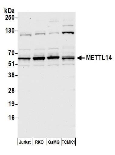 METTL14 Antibody (aa25-75)