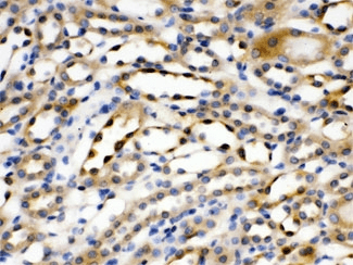 ACTN4 Antibody
