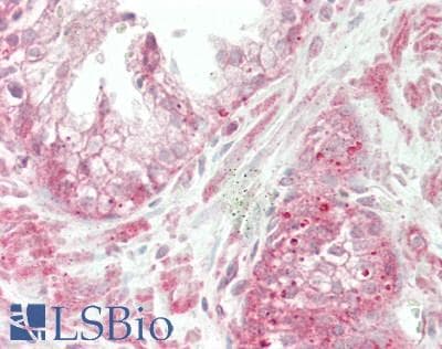 IHC-plus™ Polyclonal Rabbit anti-Human HUPF2 / UPF2 Antibody (aa1-50, IHC, WB)