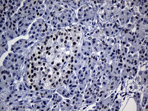 TP53BP1 / 53BP1 Antibody (aa1-300, clone OTI5H4)