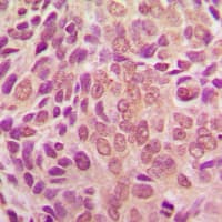 SMAD2 Antibody (Internal)