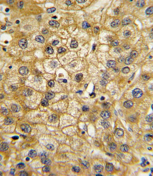 ADIPOR1/Adiponectin Receptor 1 Antibody (aa305-331)
