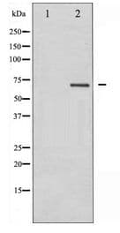 PRKCB / PKC-Beta Antibody