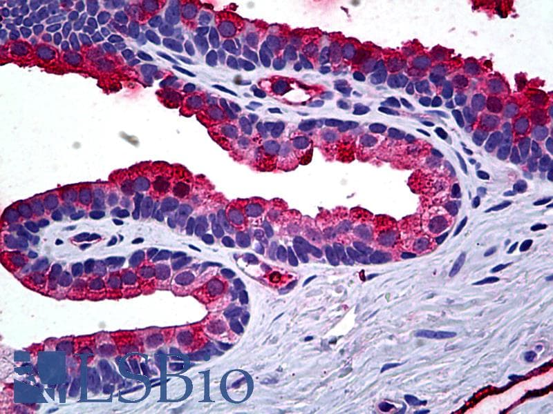 IHC-plus™ TIMP2 Antibody (clone 1C3)