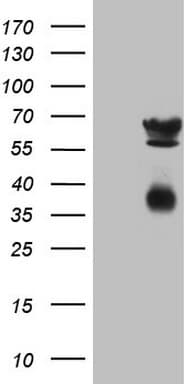 Monoclonal Mouse anti-Human CLU / Clusterin Antibody (clone OTI5D3, aa23-227, IHC, WB)