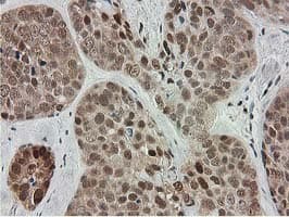 SMS / Spermine Synthase Antibody (clone OTI2G8)