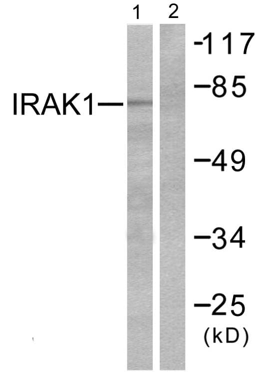 IRAK1 / IRAK Antibody (p387)