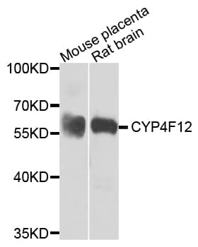 Polyclonal Rabbit anti-Human CYP4F12 Antibody (WB)