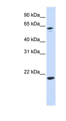 APRT Antibody (N-Terminus)