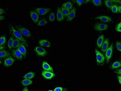 Polyclonal Rabbit anti-Human ZDHHC15 Antibody