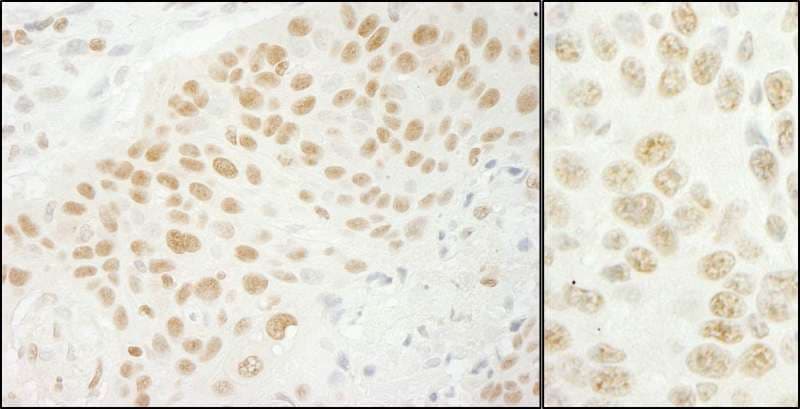 Polyclonal Rabbit anti-Human U2AF1 Antibody (aa140-190, IHC, WB)