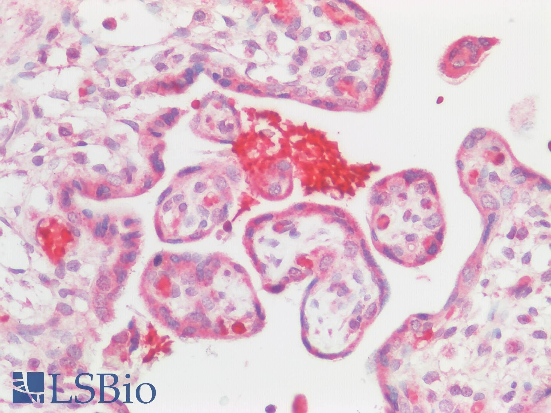 PathPlus™ Polyclonal Rabbit anti-Human BMP6 Antibody (IHC)