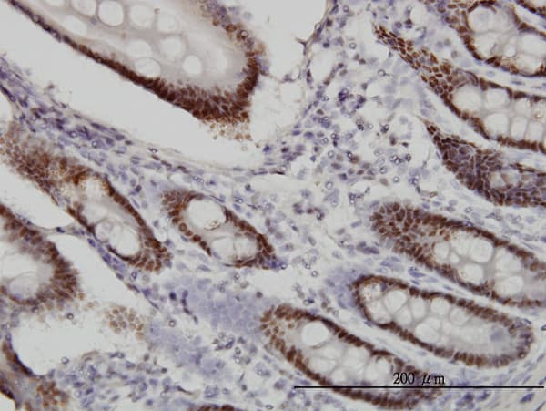 WDR4 Antibody (clone 1F9)